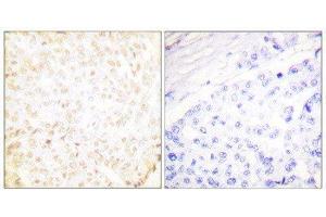 Immunohistochemistry (IHC) image for anti-X-Ray Repair Complementing Defective Repair in Chinese Hamster Cells 5 (Double-Strand-Break Rejoining) (XRCC5) (C-Term) antibody (ABIN1848903) (XRCC5 antibody  (C-Term))