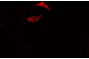 ABIN6275474 staining Hela cells by IF/ICC. (RAP2B antibody  (Internal Region))