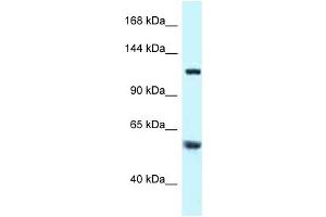Western Blot showing TBCD antibody used at a concentration of 1 ug/ml against Hela Cell Lysate (TBCD antibody  (N-Term))