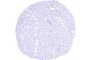 Heart muscle showing a moderate to strong TRIM72 staining of muscle cells of small artery walls