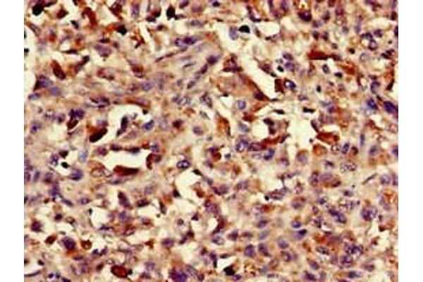 ASH1L antibody  (AA 1906-2160)