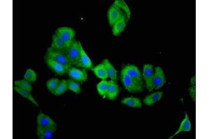 Immunofluorescent analysis of HepG2 cells using ABIN7160716 at dilution of 1:100 and Alexa Fluor 488-congugated AffiniPure Goat Anti-Rabbit IgG(H+L) (Aminoacylase 3 antibody  (AA 5-319))