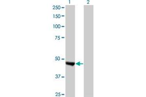 Western Blot analysis of KIAA0261 expression in transfected 293T cell line by KIAA0261 monoclonal antibody (M02), clone 2B3. (WAPAL antibody  (AA 1-402))