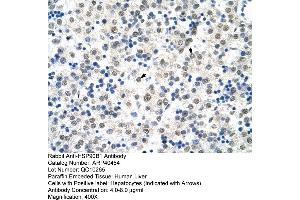 Rabbit Anti-HSP90B1 Antibody  Paraffin Embedded Tissue: Human Liver Cellular Data: Hepatocytes Antibody Concentration: 4. (GRP94 antibody  (N-Term))