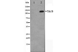 Western blot analysis of Trk B expression in HepG2 whole cell lysates,The lane on the left is treated with the antigen-specific peptide. (TRKB antibody  (C-Term))