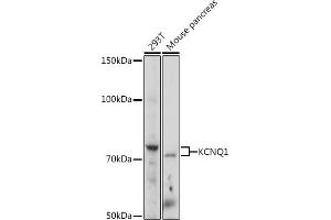 Western blot analysis of extracts of various cell lines, using KCNQ1 Rabbit pAb (ABIN3023120, ABIN3023121, ABIN3023122 and ABIN6219399) at 1:1000 dilution. (KCNQ1 antibody  (AA 250-549))