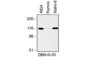 Image no. 1 for anti-Drebrin 1 (DBN1) (AA 1-326), (N-Term) antibody (ABIN1449383) (DBN1 antibody  (N-Term))