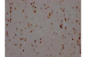 Immunohistochemistry (IHC) image for anti-Non-POU Domain Containing, Octamer-Binding (NONO) antibody (ABIN7127643)