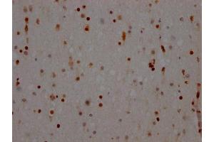 IHC image of ABIN7127643 diluted at 1:100 and staining in paraffin-embedded human brain tissue performed on a Leica BondTM system. (Recombinant NONO antibody)