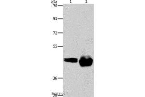 Western blot analysis of A549 and Raji cell, using CD38 Polyclonal Antibody at dilution of 1:520