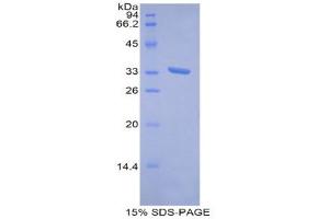 SDS-PAGE (SDS) image for Metallothionein 1E (MT1E) (AA 1-61) protein (His tag,GST tag) (ABIN1821726)