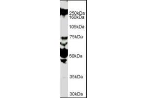 Antibody (1 µg/ml) staining of HUVEC lysate (35 µg protein in RIPA buffer). (ROBO1 antibody  (Internal Region))