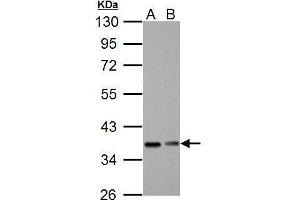 WB Image IKB alpha antibody detects IKB alpha protein by Western blot analysis. (NFKBIA antibody  (Center))