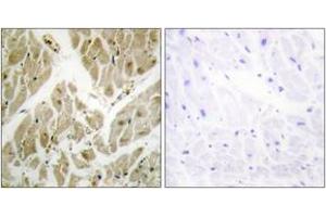 Immunohistochemistry analysis of paraffin-embedded human heart tissue, using API-5 Antibody. (Apoptosis Inhibitor 5 antibody  (AA 421-470))