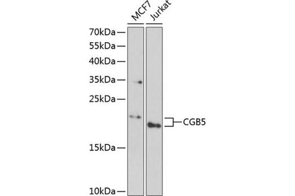 CGB5 antibody  (AA 20-165)