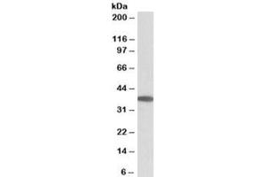 Western blot testing of human duodenum lysate with MOGAT2 antibody at 0. (MOGAT2 antibody)