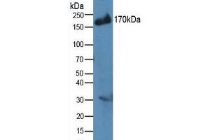 Western blot analysis of Human MCF7 Cells. (IRS2 antibody  (AA 985-1255))