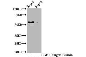 Western Blot Positive WB detected in HepG2 whole cell lysate(treated with EGF or not) All lanes Phospho-MYC antibody at 0. (Recombinant c-MYC antibody  (pSer62, pThr58))