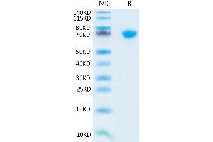 Human TNFSF15 Trimer on Tris-Bis PAGE under reduced condition. (TNFSF15 Protein (Trimer) (His-DYKDDDDK Tag))