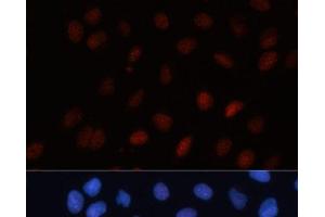 Immunofluorescence analysis of U-2 OS cells using SUMO1 Polyclonal Antibody at dilution of 1:100. (SUMO1 antibody)