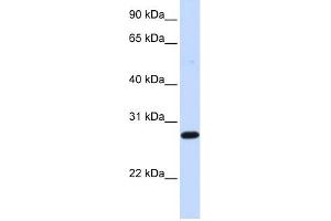 DCK antibody used at 1 ug/ml to detect target protein. (DCK antibody  (Middle Region))