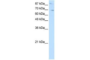 WB Suggested Anti-SKIL Antibody Titration:  2. (SKIL antibody  (N-Term))