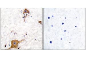 Immunohistochemistry (IHC) image for anti-Neuregulin 1 (NRG1) (Isoform 10), (N-Term) antibody (ABIN1848607) (Neuregulin 1 antibody  (Isoform 10, N-Term))