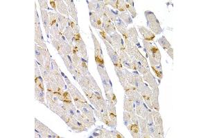 Immunohistochemistry of paraffin-embedded mouse heart using DSP antibody (ABIN6291454) at dilution of 1:100 (40x lens). (Desmoplakin antibody)