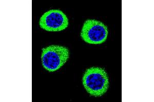 Confocal immunofluorescent analysis of CPSF3L Antibody (N-term) (ABIN655113 and ABIN2844744) with U-251MG cell followed by Alexa Fluor 488-conjugated goat anti-rabbit lgG (green). (CPSF3L antibody  (N-Term))