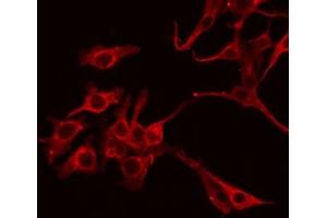 Immunofluorescence (fixed cells) (IF/ICC) image for anti-Intercellular Adhesion Molecule 1 (ICAM1) (pTyr512) antibody (ABIN6255938)