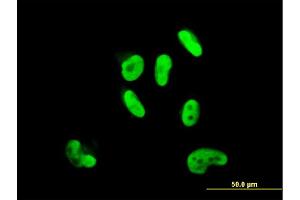 Immunofluorescence of monoclonal antibody to SOX9 on HepG2 cell. (SOX9 antibody  (AA 400-509))