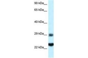 Image no. 1 for anti-Ribosomal Protein S9 (RPS9) (C-Term) antibody (ABIN6747457) (RPS9 antibody  (C-Term))