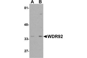 Western blot analysis of WDR92 in human kidney tissue lysate with WDR92 antibody at (A) 1 and (B) 2 μg/ml. (WDR92 antibody  (Center))