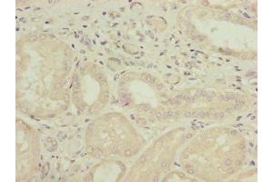 Immunohistochemistry of paraffin-embedded human kidney tissue using ABIN7163868 at dilution of 1:100 (GALNT14 antibody  (AA 35-335))