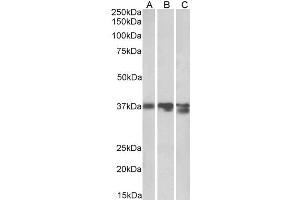 Western Blotting (WB) image for anti-Arginase, Liver (ARG1) antibody (ABIN5913081) (Liver Arginase antibody)