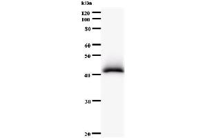 Western Blotting (WB) image for anti-PDS5, Regulator of Cohesion Maintenance, Homolog B (PDS5B) antibody (ABIN931004) (PDS5B antibody)