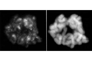 Histone H3. (Histone H3.1 antibody  (pSer28, Ser28))