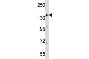 Western Blotting (WB) image for anti-Adenomatous Polyposis Coli (APC) (AA 1148-1176) antibody (ABIN3029869)