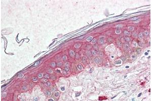 Anti-TSPAN6 antibody  ABIN960831 IHC staining of human skin. (Tetraspanin 6 antibody  (Internal Region))
