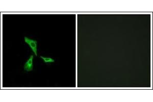 Immunofluorescence analysis of HeLa cells, using GPR101 Antibody.