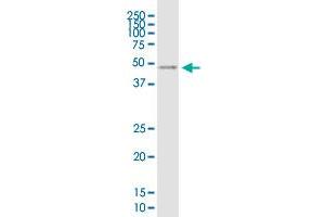 VSTM1 monoclonal antibody (M03), clone 2E12. (VSTM1 antibody  (AA 1-174))