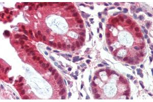 Immunohistochemistry with Human Colon lysate tissue at an antibody concentration of 5. (NR1I3 antibody  (Middle Region))