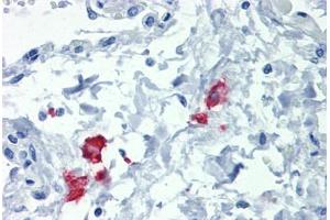 Immunohistochemistry (Formalin-fixed Paraffin-embedded Sections) (IHC (fp)) image for anti-CD209 (CD209) antibody (ABIN462467)