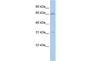 WB Suggested Anti-EFHA2 Antibody Titration: 0. (EFHA2 antibody  (N-Term))