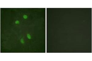 Immunofluorescence analysis of HeLa cells, using ATF2 (Ab-480) Antibody.