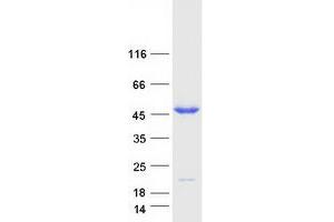 Validation with Western Blot (PPM1B Protein (Transcript Variant 2) (Myc-DYKDDDDK Tag))