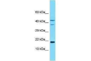 Western Blotting (WB) image for anti-NADH Dehydrogenase (Ubiquinone) 1 alpha Subcomplex, 8, 19kDa (NDUFA8) (Middle Region) antibody (ABIN2774343) (NDUFA8 antibody  (Middle Region))