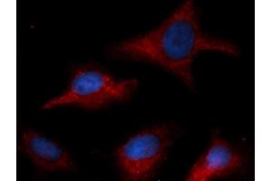 Immunofluorescence (IF) image for anti-Coagulation Factor III (thromboplastin, Tissue Factor) (F3) antibody (APC) (ABIN5567677) (Tissue factor antibody  (APC))
