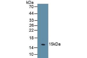 Detection of Recombinant PPARg, Human using Monoclonal Antibody to Peroxisome Proliferator Activated Receptor Gamma (PPARg) (PPARG antibody  (AA 157-274))