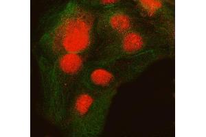 IF analysis of SNRNP200 and Tubulin beta using anti-SNRNP200 antibody (ABIN7602032) and anti-Tubulin beta antibody (ABIN7602744). (SNRNP200 antibody  (AA 557-2129))